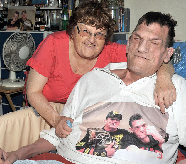 英&ldquo;巨人癥&rdquo;男子高超2米仍在長(zhǎng)