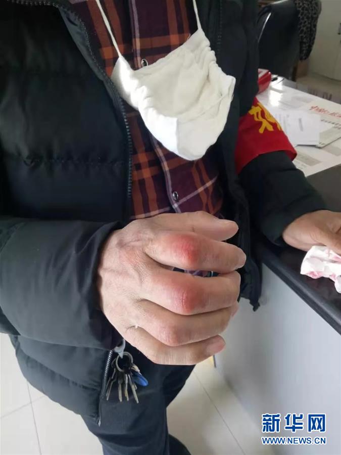 （在習(xí)近平新時(shí)代中國(guó)特色社會(huì)主義思想指引下&mdash;&mdash;新時(shí)代新作為新篇章&middot;習(xí)近平總書(shū)記關(guān)切事&middot;圖文互動(dòng)）（2）戰(zhàn)&ldquo;疫&rdquo;中的&ldquo;凡人微光&rdquo;